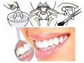 Mouth guard - 6.2G/Pc; 2Pcs/opp packing ,EVA (EHW1256)